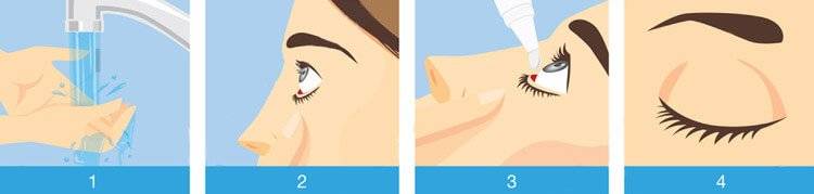 Глазные капли от раздражения и покраснения: перечень препаратов от воспаления, зуда, красных глаз для детей и взрослых с примерами дешевых средств