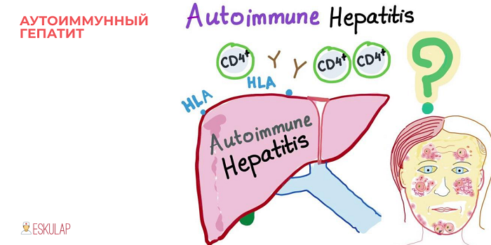 Гепатиты а, в и с: в чем разница, пути заражения, симптомы и лечения