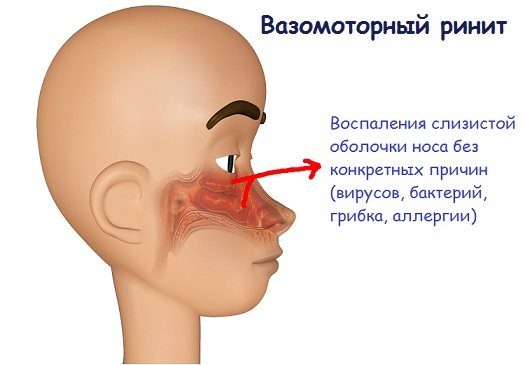 Грибок на лице: симптомы и лечение заболевания