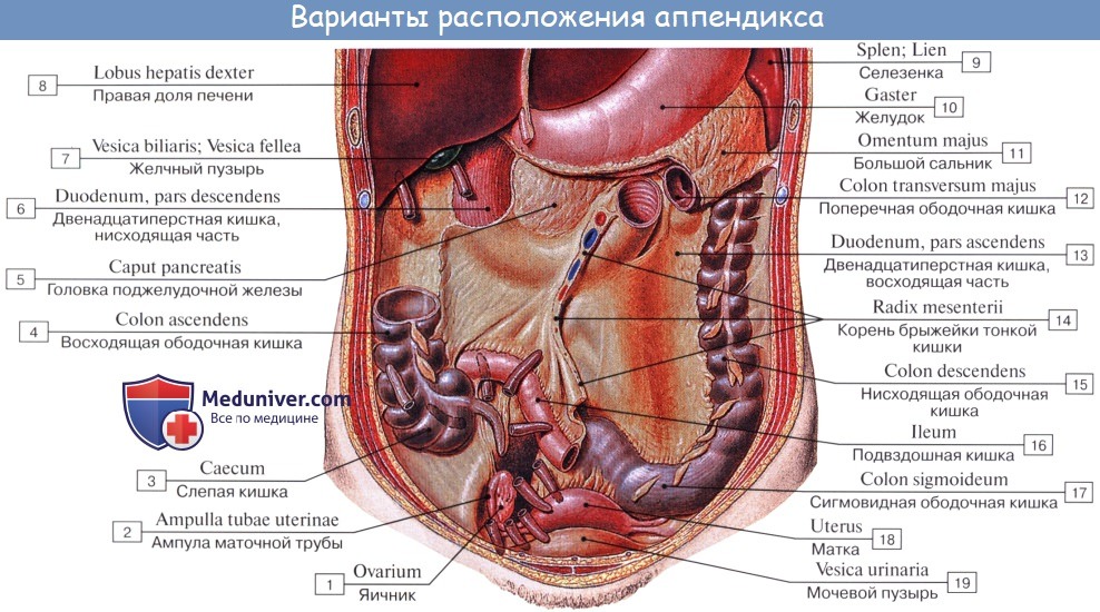 Где расположен аппендицит у человека схема расположения у женщин фото