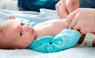 Мокнущий пупок у новорожденных: лечение и профилактика омфалита
