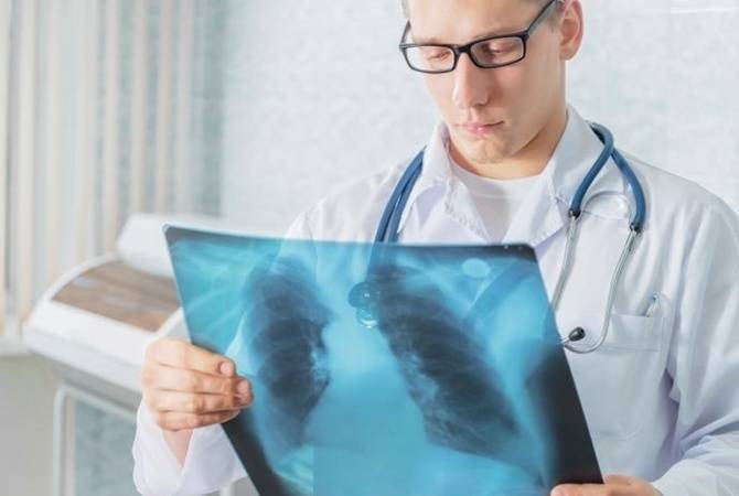 Туберкулез: как выявить на ранней стадии?