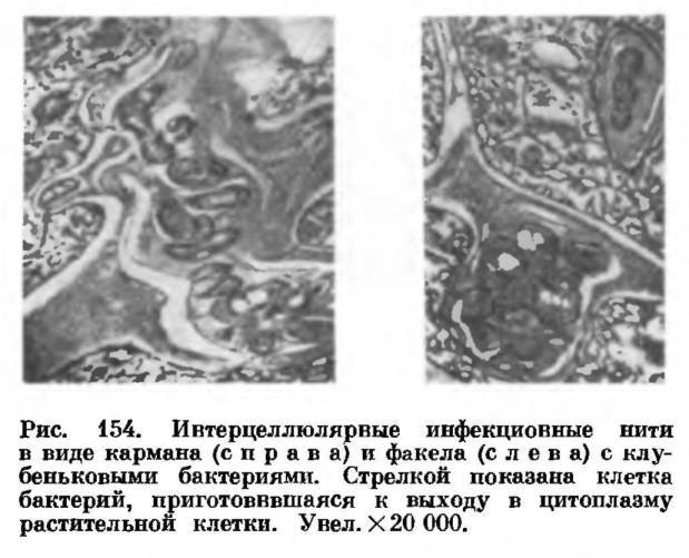 Рассмотрите рисунок и опишите то что вы видите сформулируйте основные функции клубеньковых бактерий