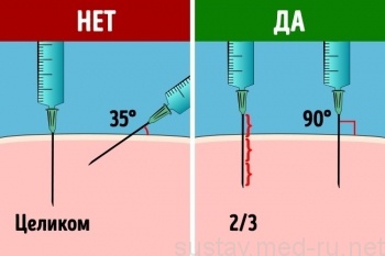 Почему мелоксикам‐солофарм в уколах безопасней своих аналогов? расширенная инструкция по применению для лечения суставов