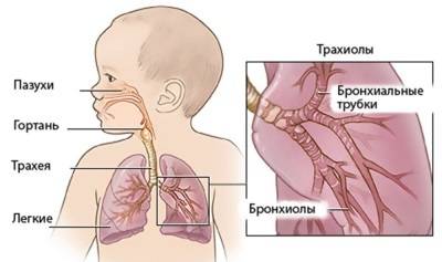 Пневмония у новорожденных: причины и лечение