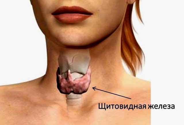 Рак щитовидной железы. симптомы, признаки, причины, диагностика и лечение заболевания.