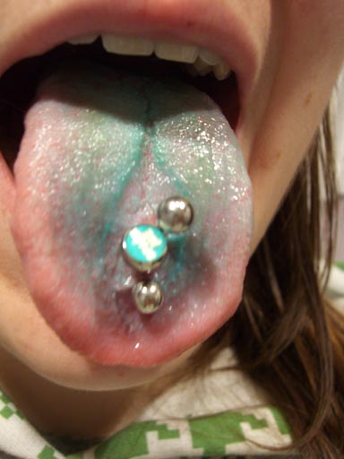Проколола язык и болят зубы