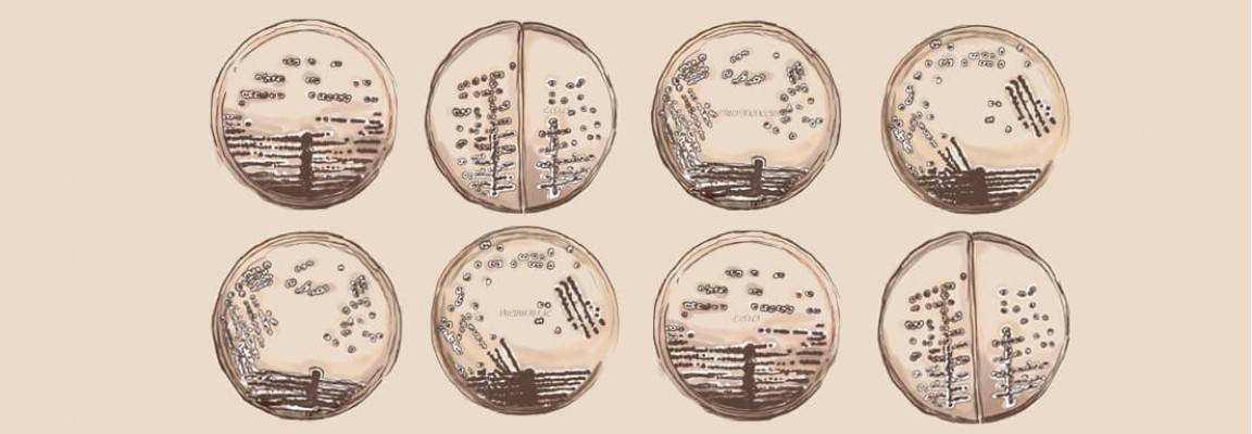 Что значит бактерии в моче у мужчин