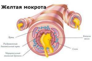 Мокрота желтая с кашлем без температуры что делать. Смотреть фото Мокрота желтая с кашлем без температуры что делать. Смотреть картинку Мокрота желтая с кашлем без температуры что делать. Картинка про Мокрота желтая с кашлем без температуры что делать. Фото Мокрота желтая с кашлем без температуры что делать