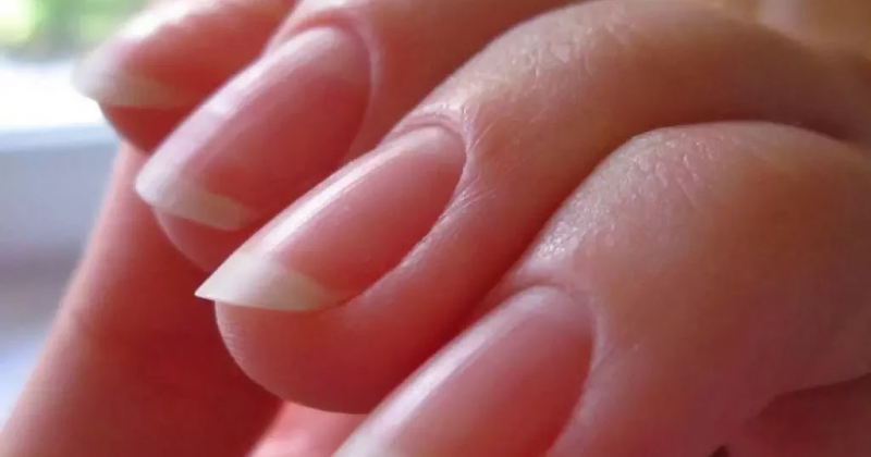 Почему слоятся ногти на руках: причины, лечение в домашних условиях