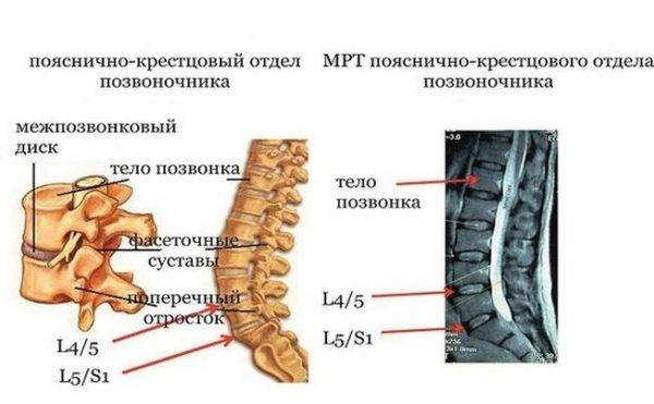 Шрамы после операции на позвоночнике фото