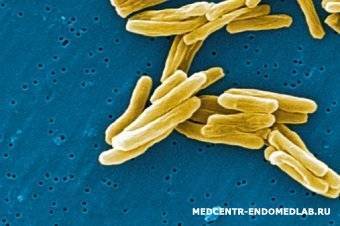 Mycobacterium tuberculosis, антитела