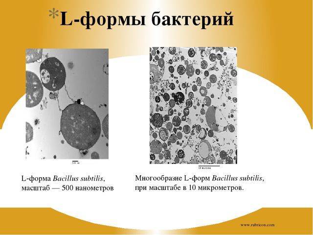 Форма л. Протопласты. L – формы бактерий.. Протопласты и сферопласты l-формы. Протопласты и сферопласты l-формы бактерий. Эль формы бактерий.