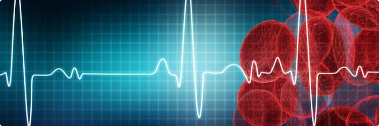 Что такое аритмия сердца и как её лечить?