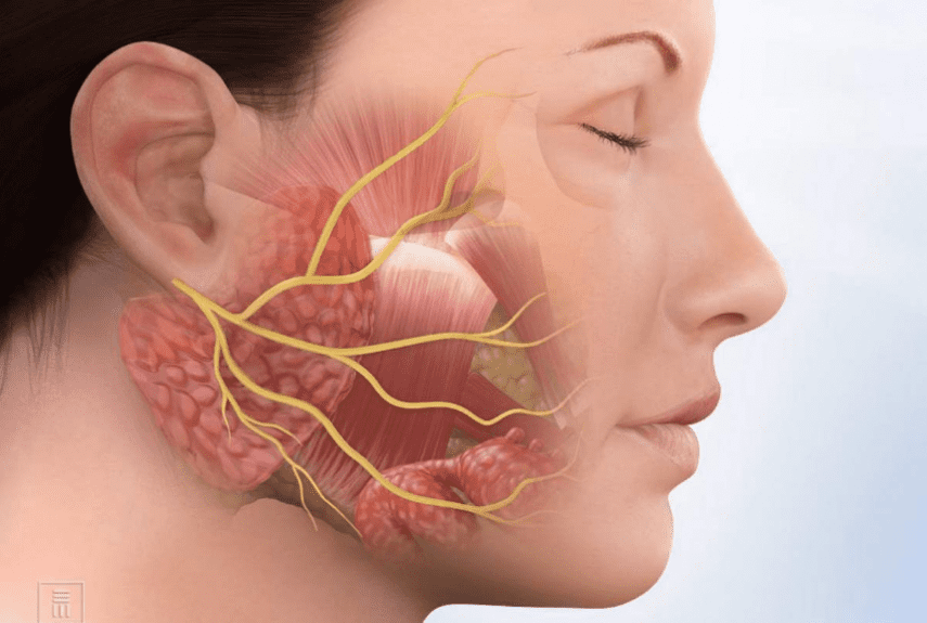 Лечение неврита лицевого нерва