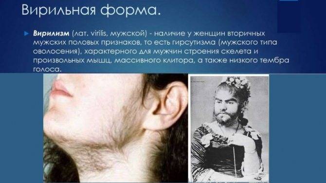 Адреногенитальный синдром у мальчиков фото