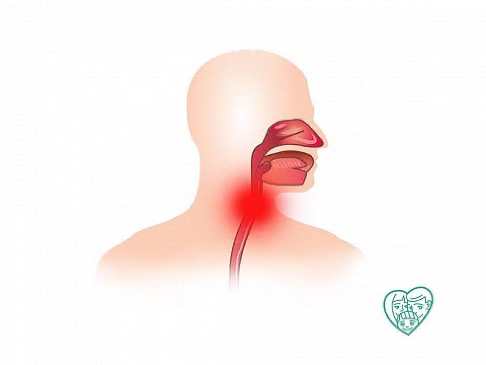 Слабый голос. Ларингит потеря голоса. Ларингит. Потеря голоса. Спрей. Лечение ларингита и синусита. Охриплость голоса комок в горле.