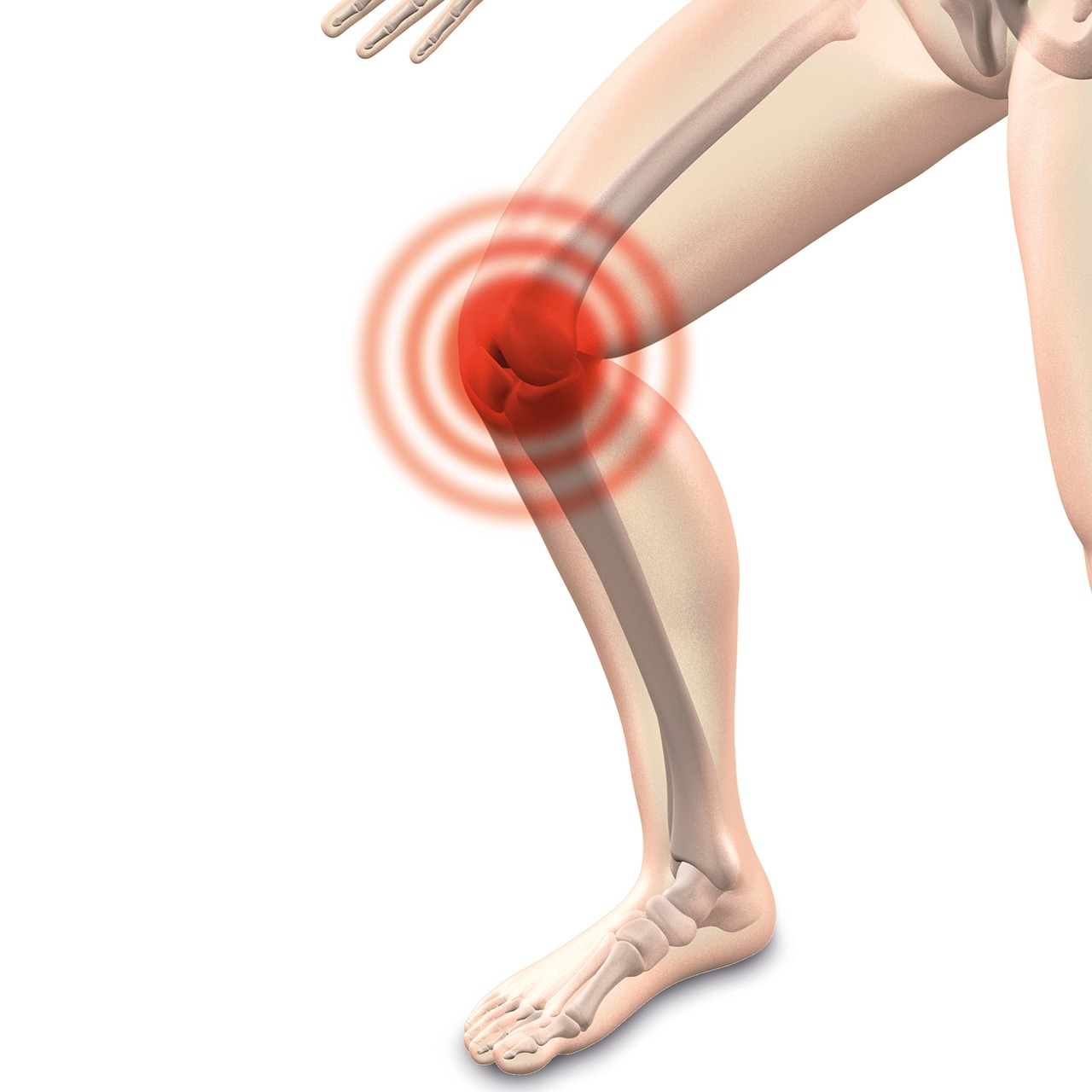 Разрыв мениска коленного сустава: причины травмы, симптомы, диагностика и методы лечения