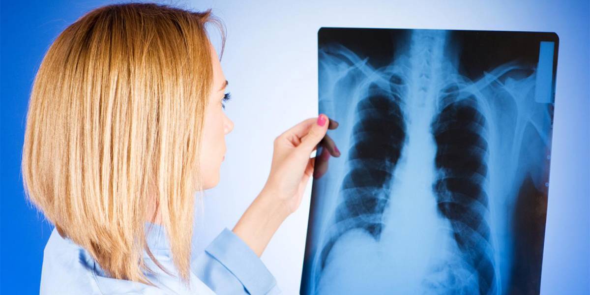 Формы туберкулеза легких: особенности и диагностика