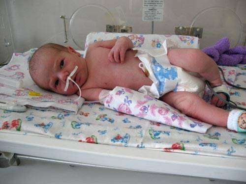 Пневмония у недоношенных детей: сколько лечиться новорожденным, внутриутробная форма