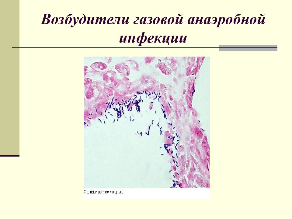 Газовая гангрена микробиология презентация
