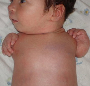 Влияет ли виагра на зачатие ребенка?