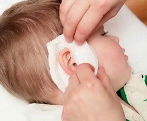 Как сделать согревающий ушной компресс ребенку: пошаговая инструкция