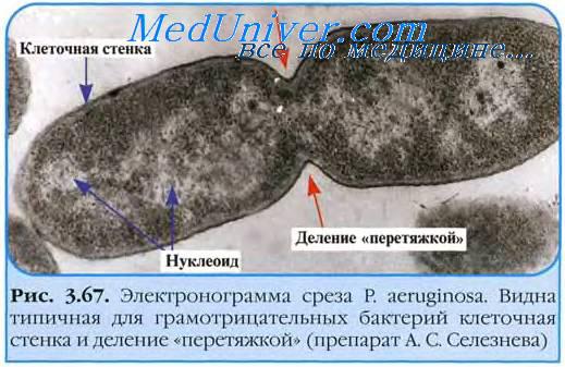 Синегнойная палочка фото больных