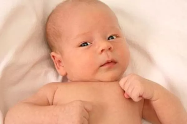 Кривошея у новорожденных (18 фото): лечение грудничка и как определить ее у ребенка, можно ли вылечить воротником, мнение доктора комаровского, отзывы