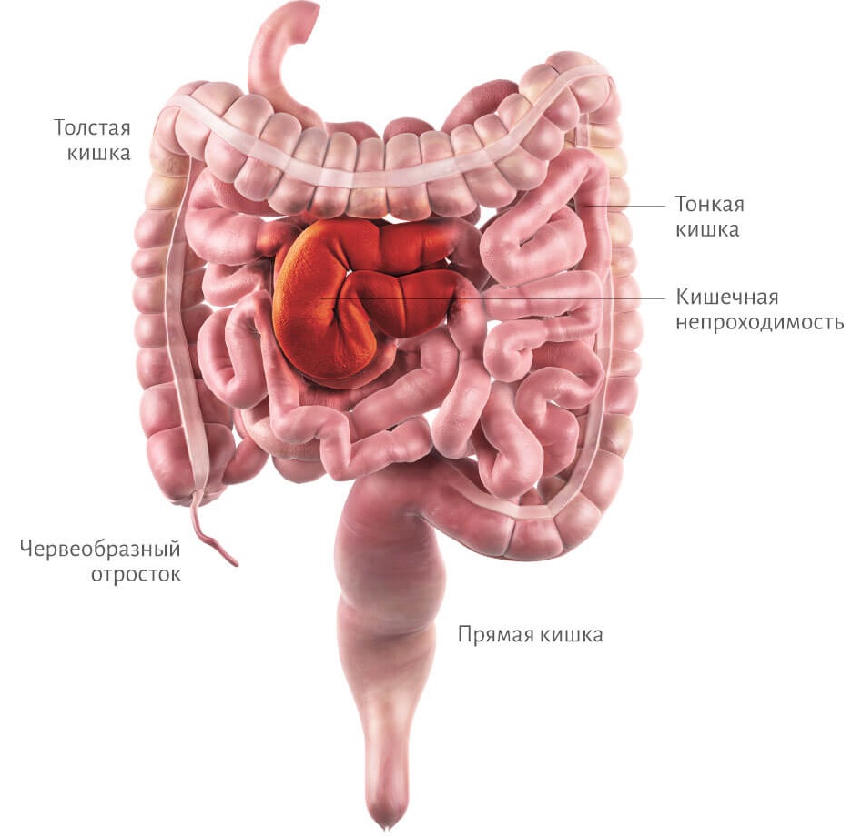 кишечник