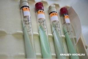 Анализ крови на туберкулез: нормы, расшифровка, как сдавать