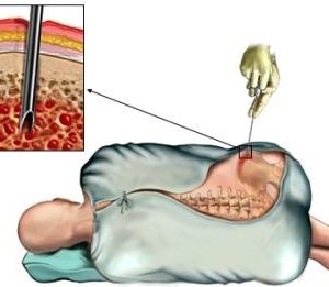 Анатомия красного костного мозга человека - информация:
