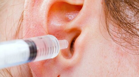 Как удалить серную пробку из уха