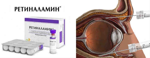 Ретиналамин (retinalamin) инструкция по применению