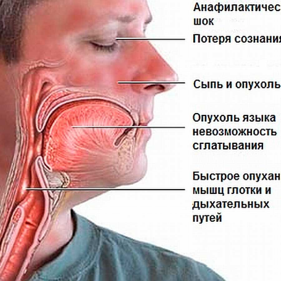 описание шока в фанфике фото 112