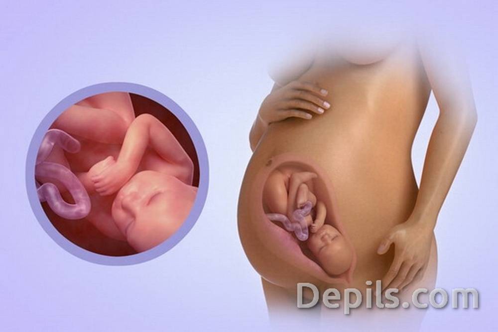 Молочница на 9 месяце беременности